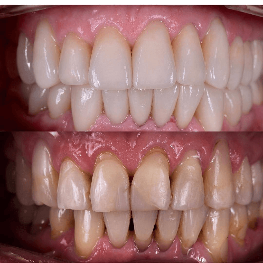 תוצאה קלינית 7  -  Doctor Ox