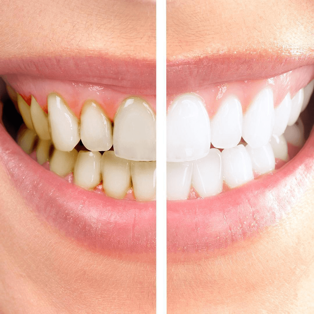 תוצאה קלינית 8  -  Doctor Ox