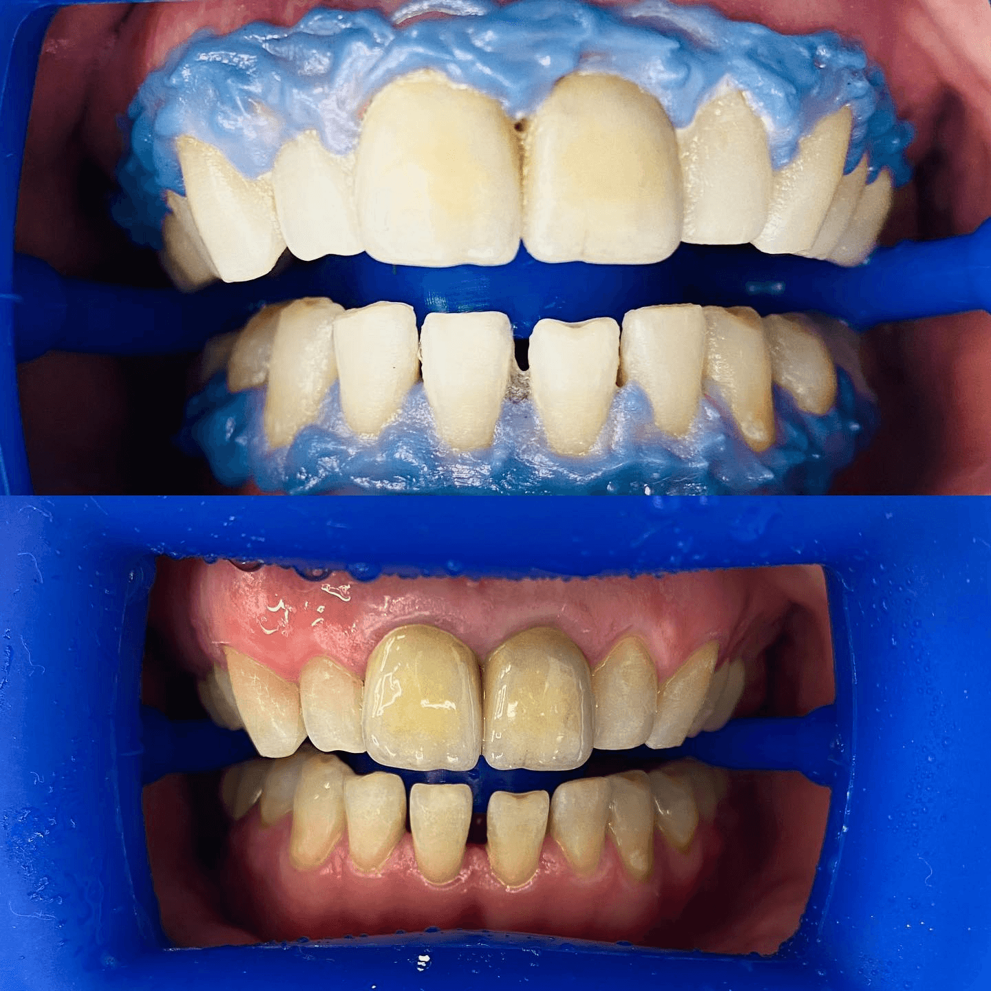 תוצאה קלינית 10  -  Doctor Ox