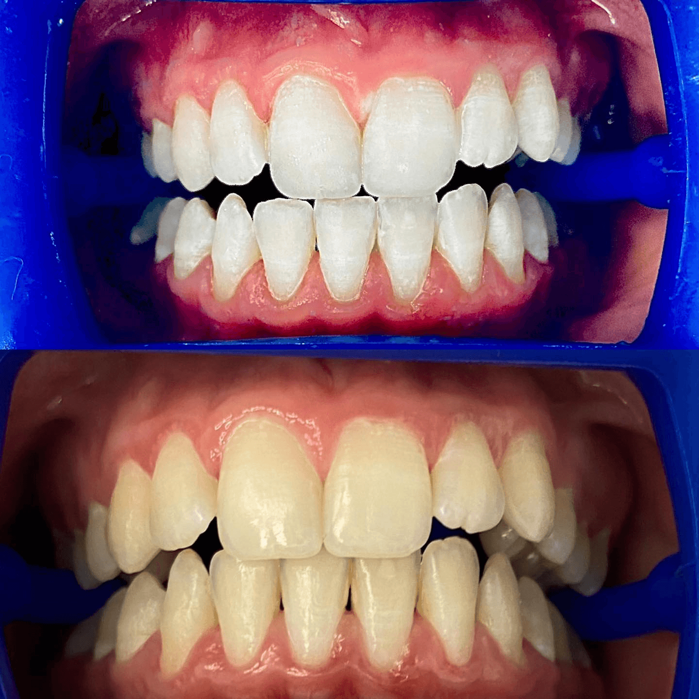 תוצאה קלינית 11  -  Doctor Ox