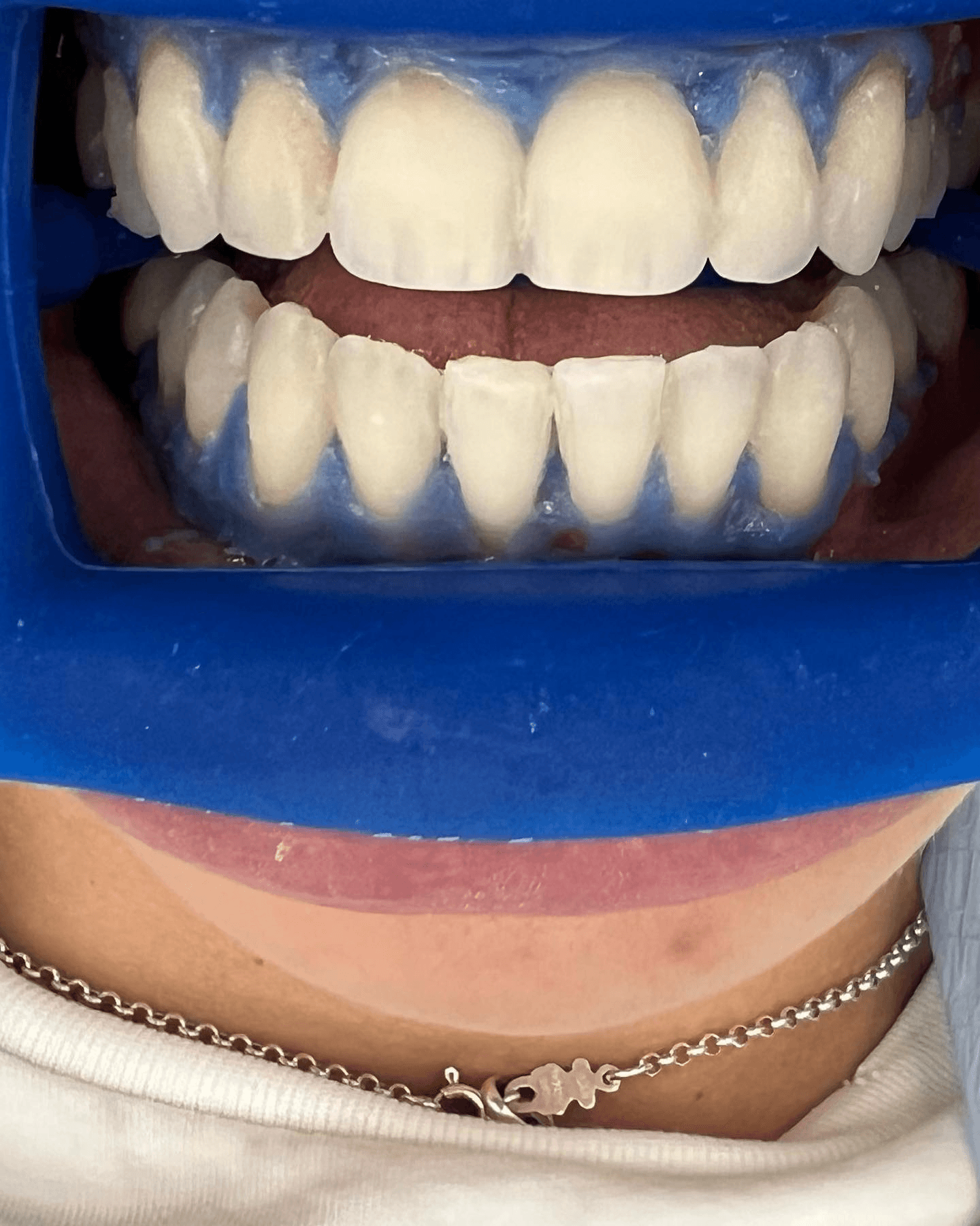 תוצאה קלינית 12  -  Doctor Ox