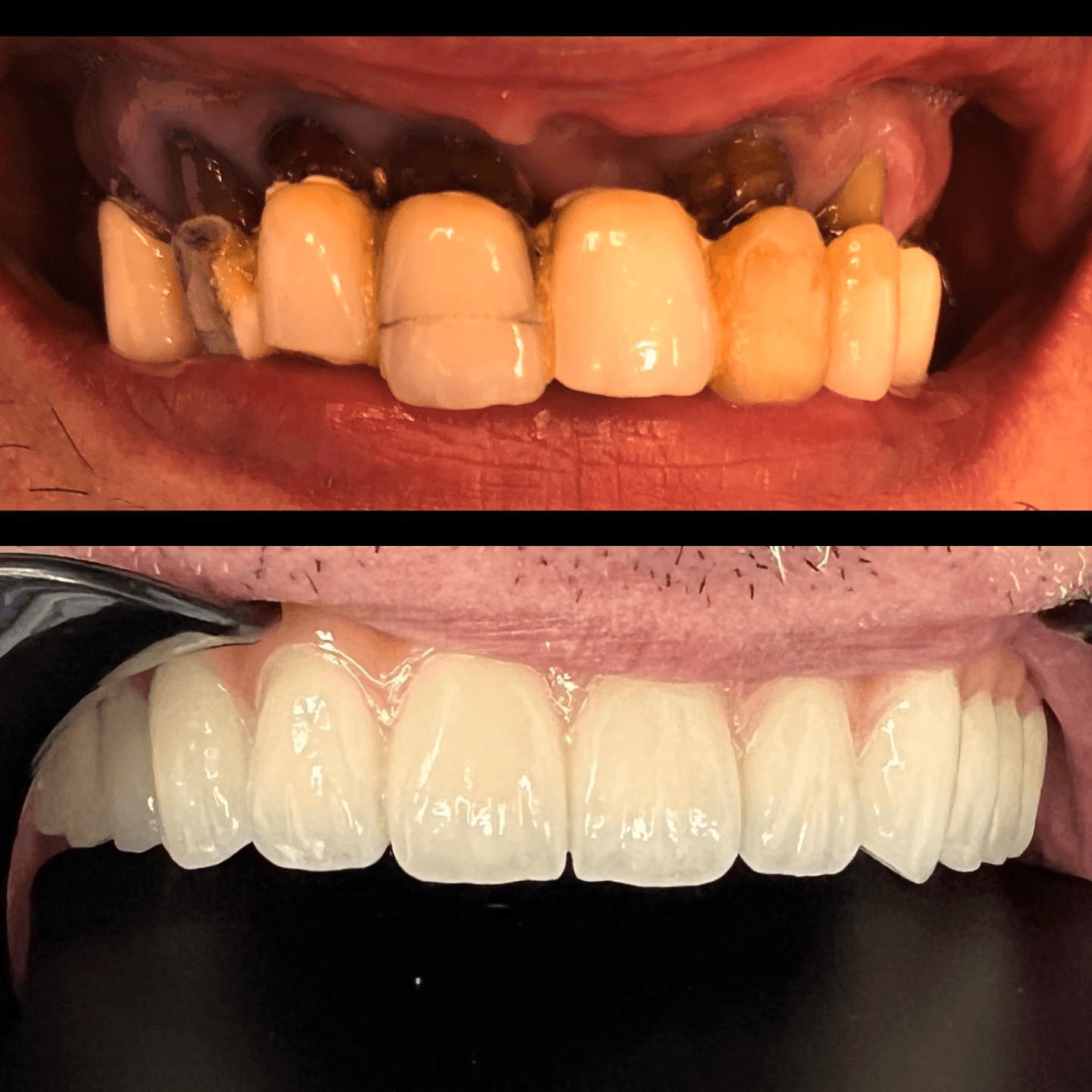 תוצאה קלינית 14  -  Doctor Ox