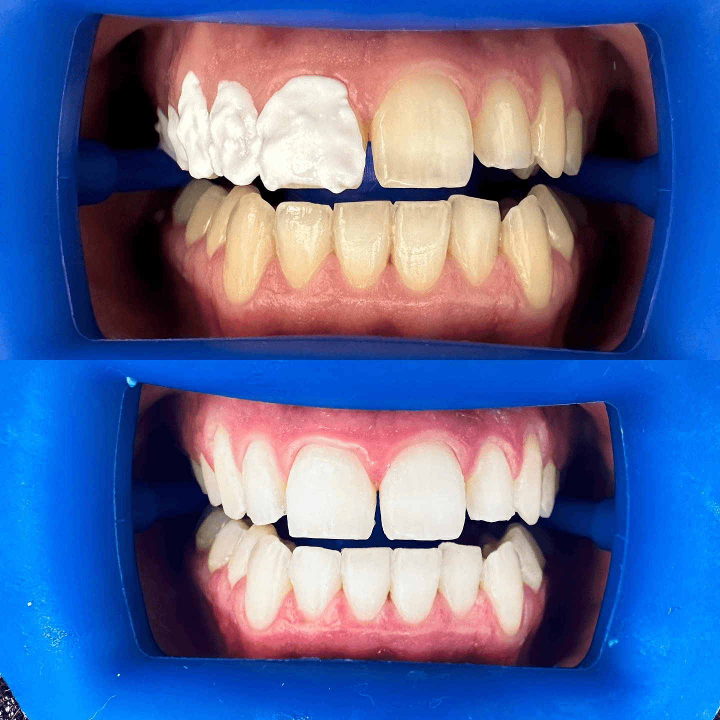 תוצאה קלינית 15  -  Doctor Ox